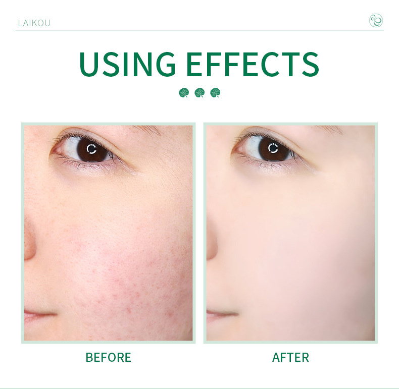 Limpador Facial Centella Asiatica Imagem 8