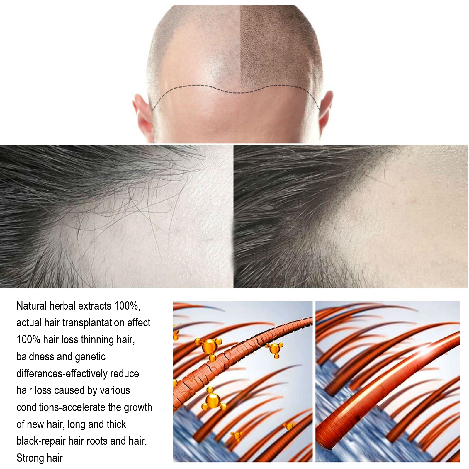 Hair Regrowth Essential Oil